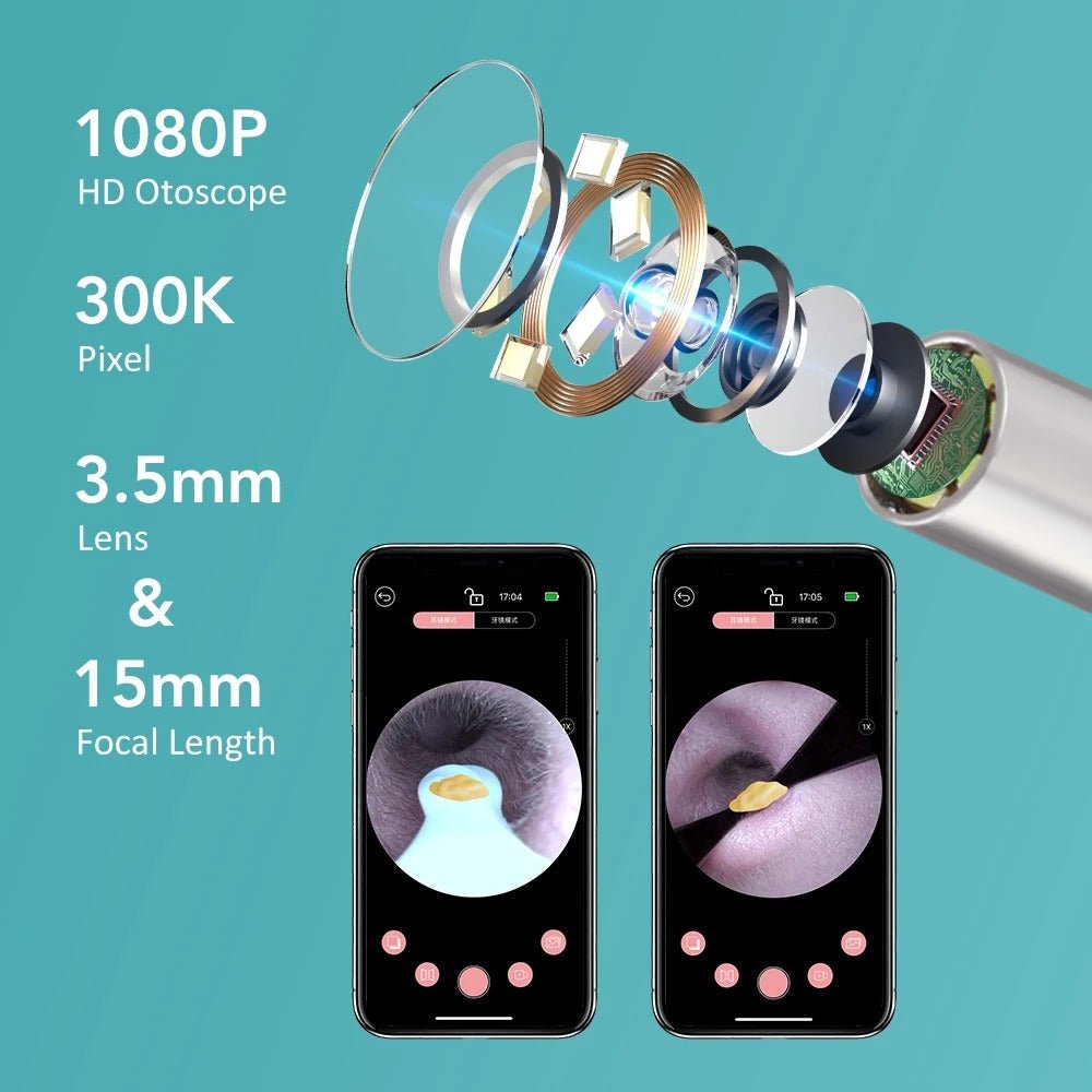 Smart Visual Ear Camera Cleaner – HD 1080P WiFi Ear Wax Removal Tool with Tweezers & 360° Rotating Endoscope - Detour Finds