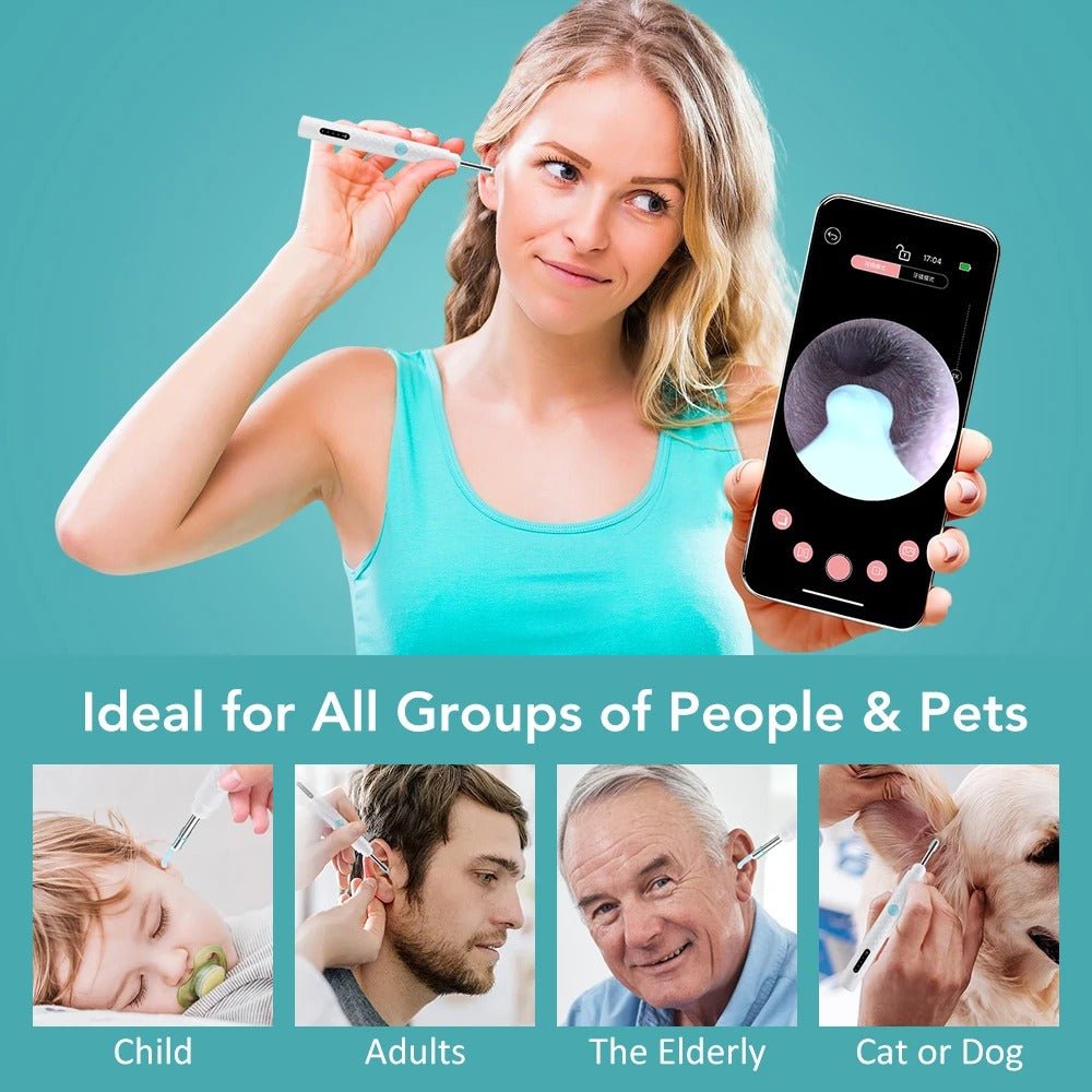 Smart Visual Ear Camera Cleaner – HD 1080P WiFi Ear Wax Removal Tool with Tweezers & 360° Rotating Endoscope - Detour Finds
